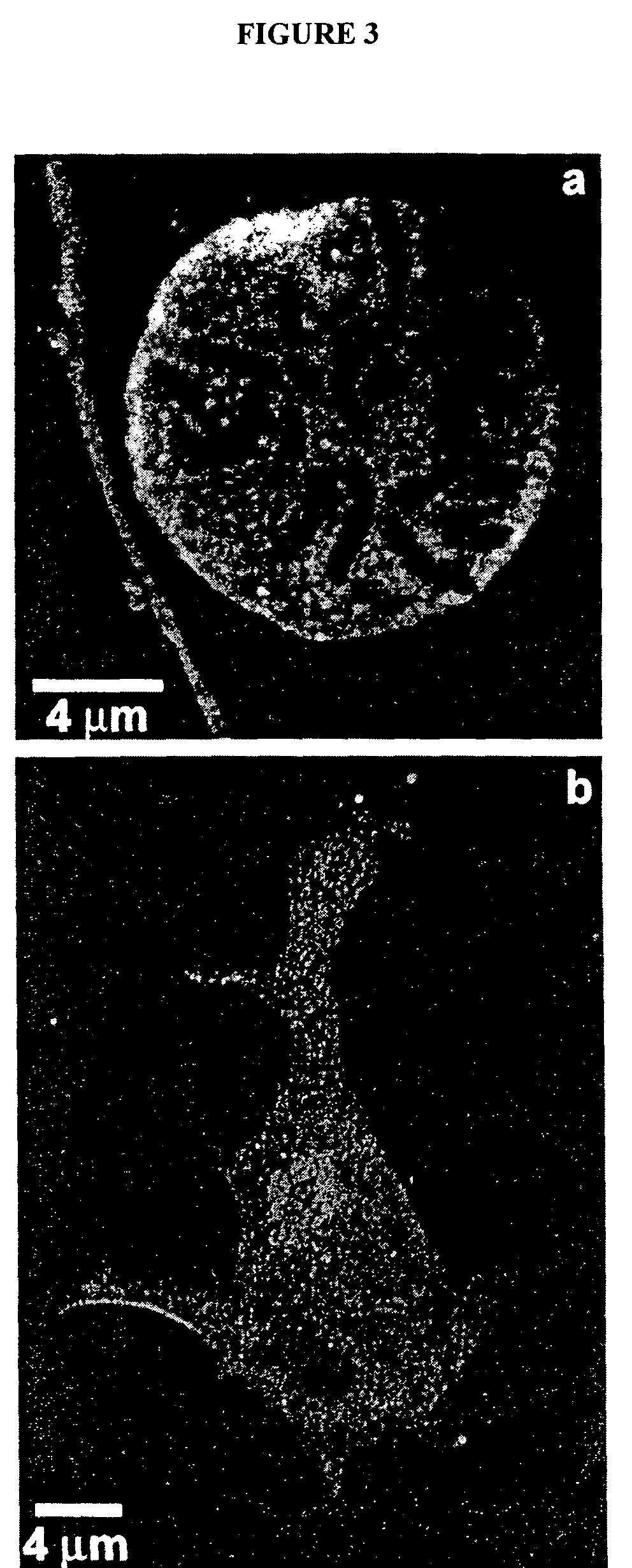 Methods for obtaining adult human olfactory progenitor cells