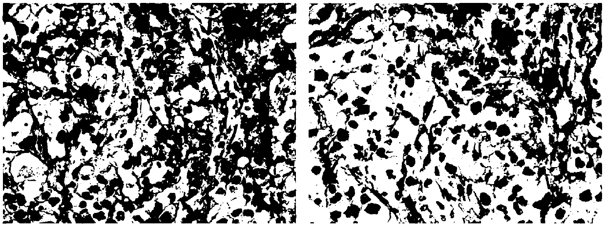 Antibody diluent for enhancing use effect of PD-L1 monoclonal antibody and use method of antibody diluent