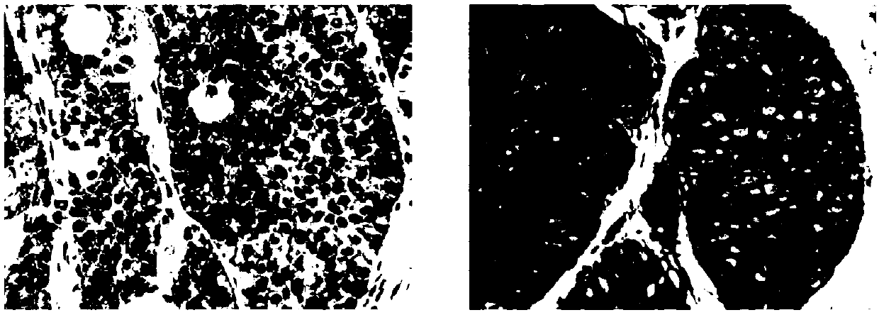 Antibody diluent for enhancing use effect of PD-L1 monoclonal antibody and use method of antibody diluent