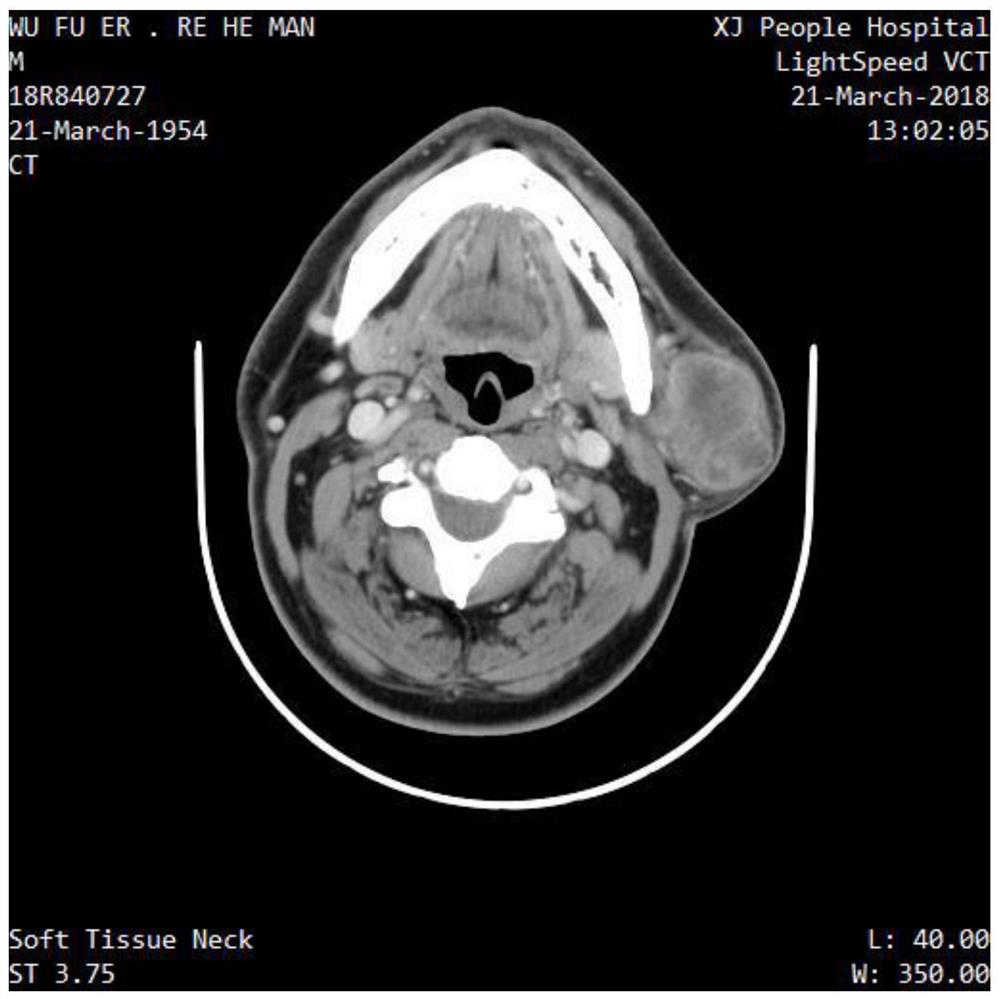 Medical image desensitization and cleaning method based on DICOM