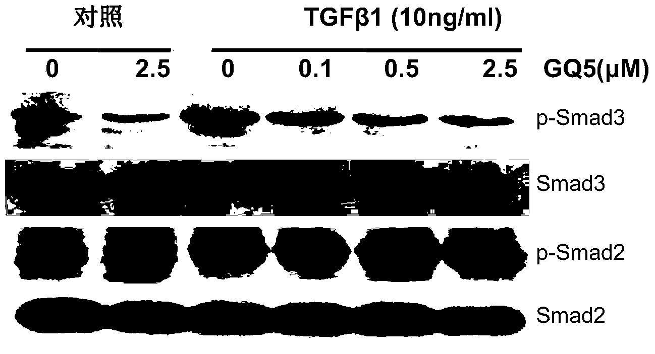 Application of urushiol-silicon polymer in preparation of medicine for inhibiting Smad3 phosphorylation