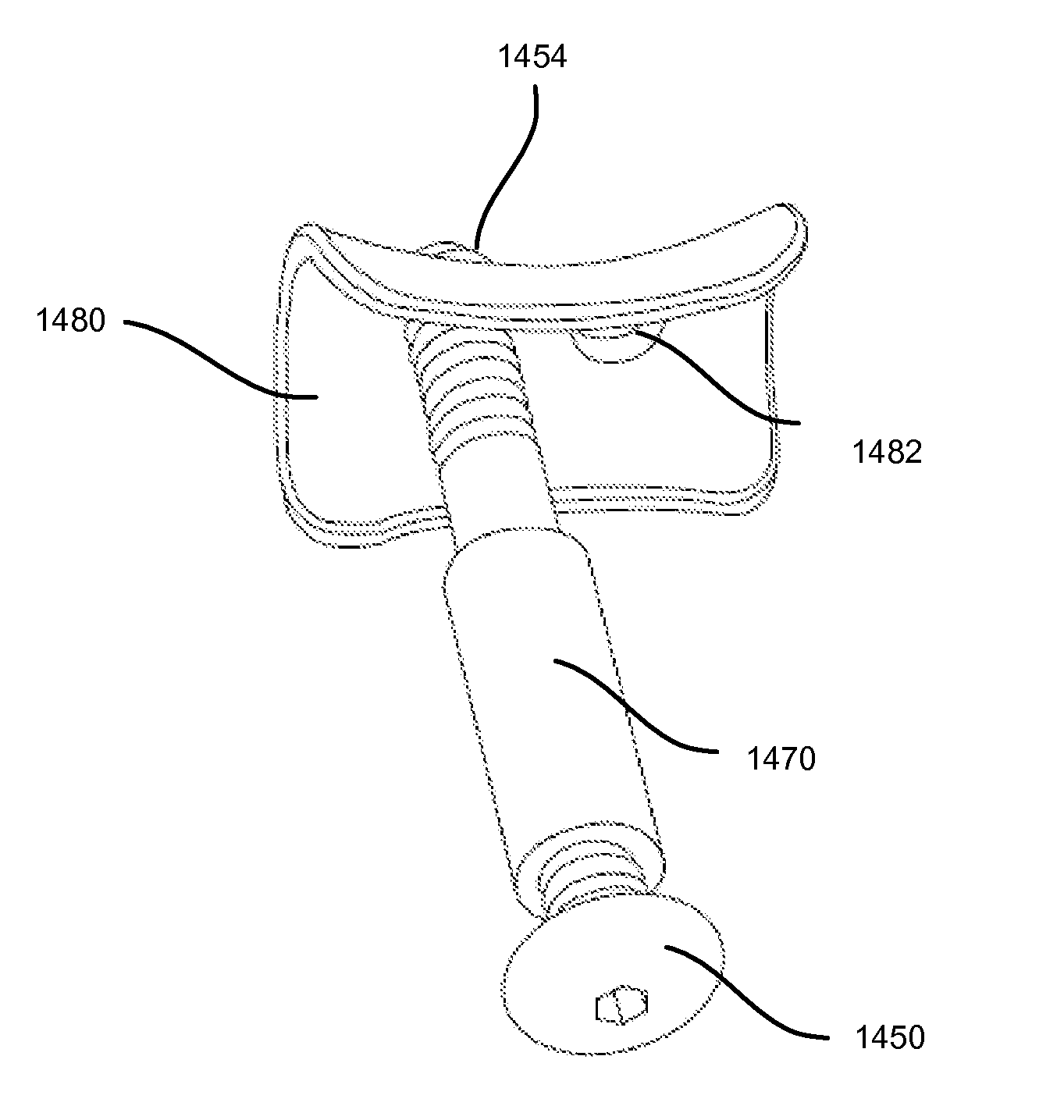 Fixation and alignment device and method used in orthopaedic surgery