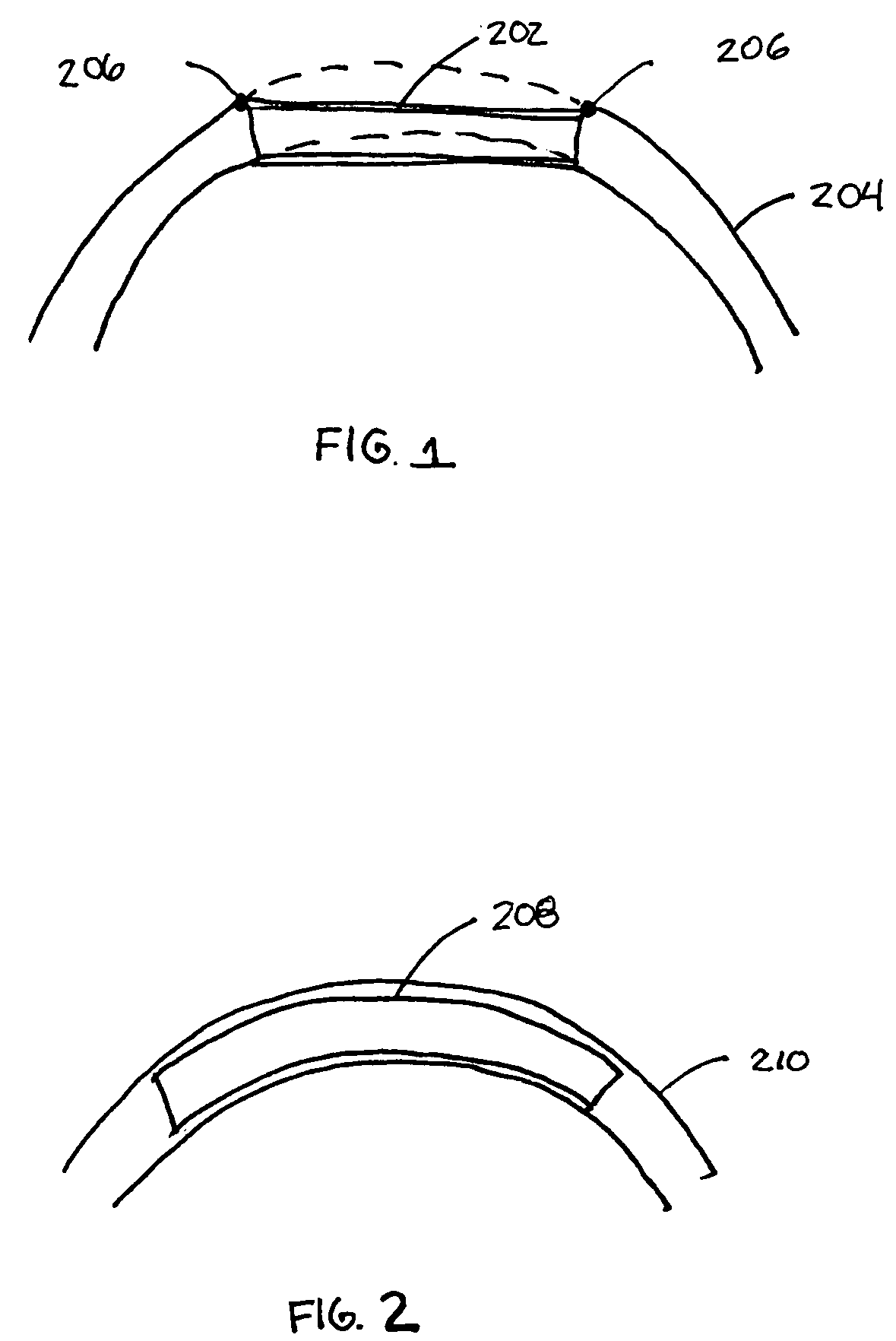 Longitudinally flexible stent