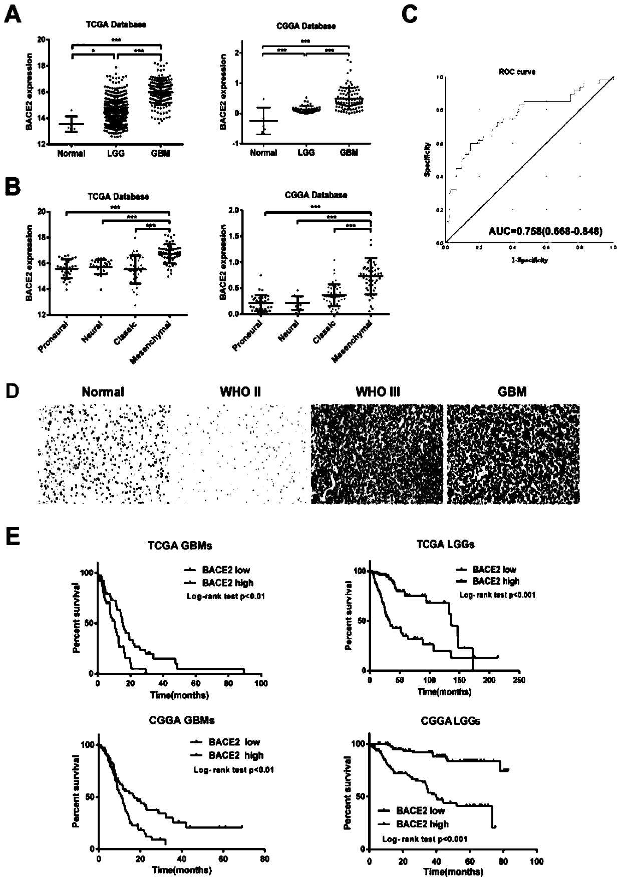 Application of BACE2 as glioma prognosis/diagnosis/treatment marker