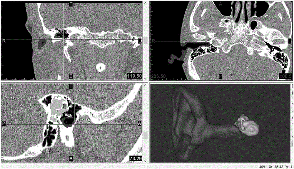 Biomechanical research, modeling, verification and application of human ear for railway vehicles