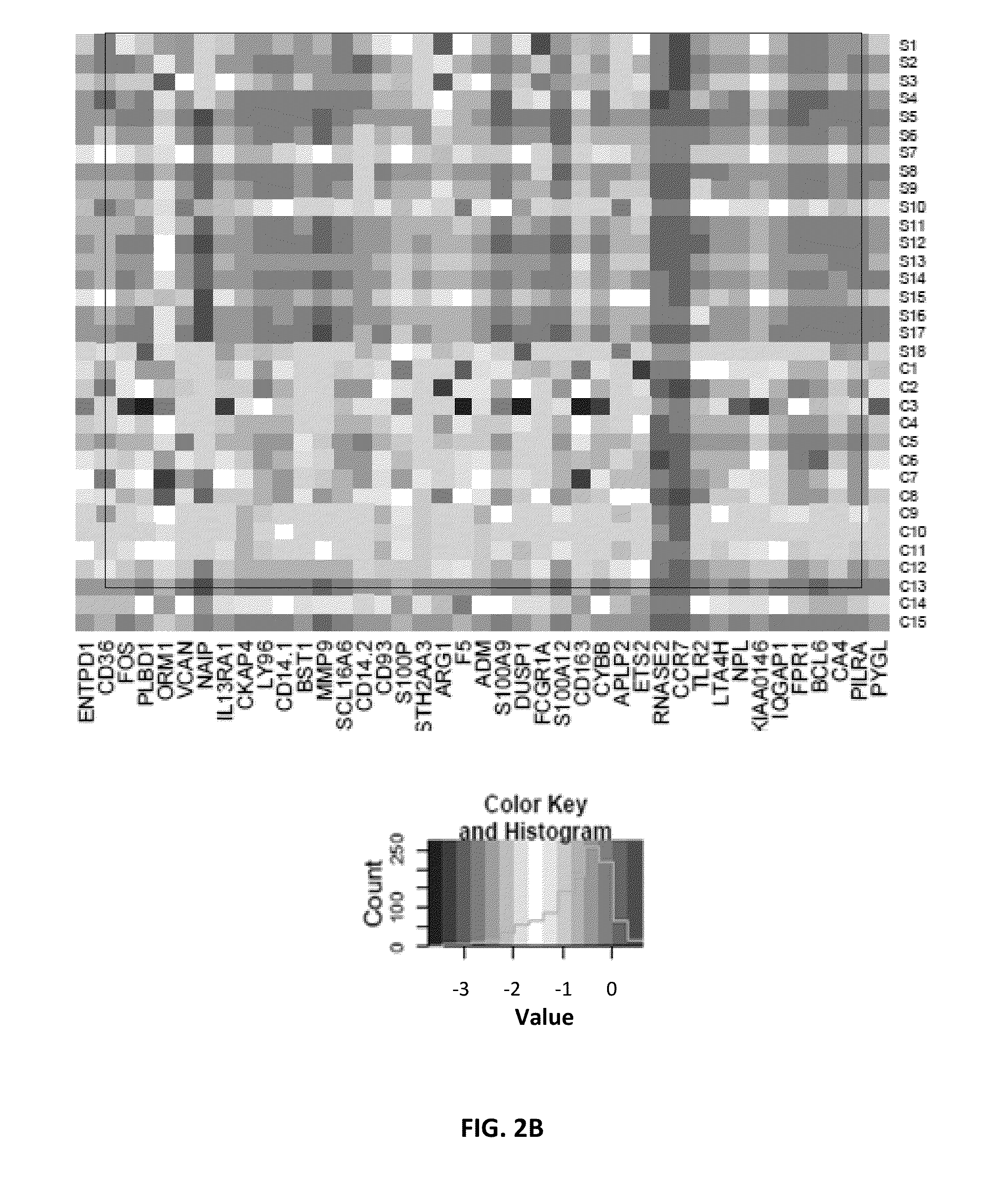 Biomarkers for predicting risk of acute ischemic stroke and methods of use thereof