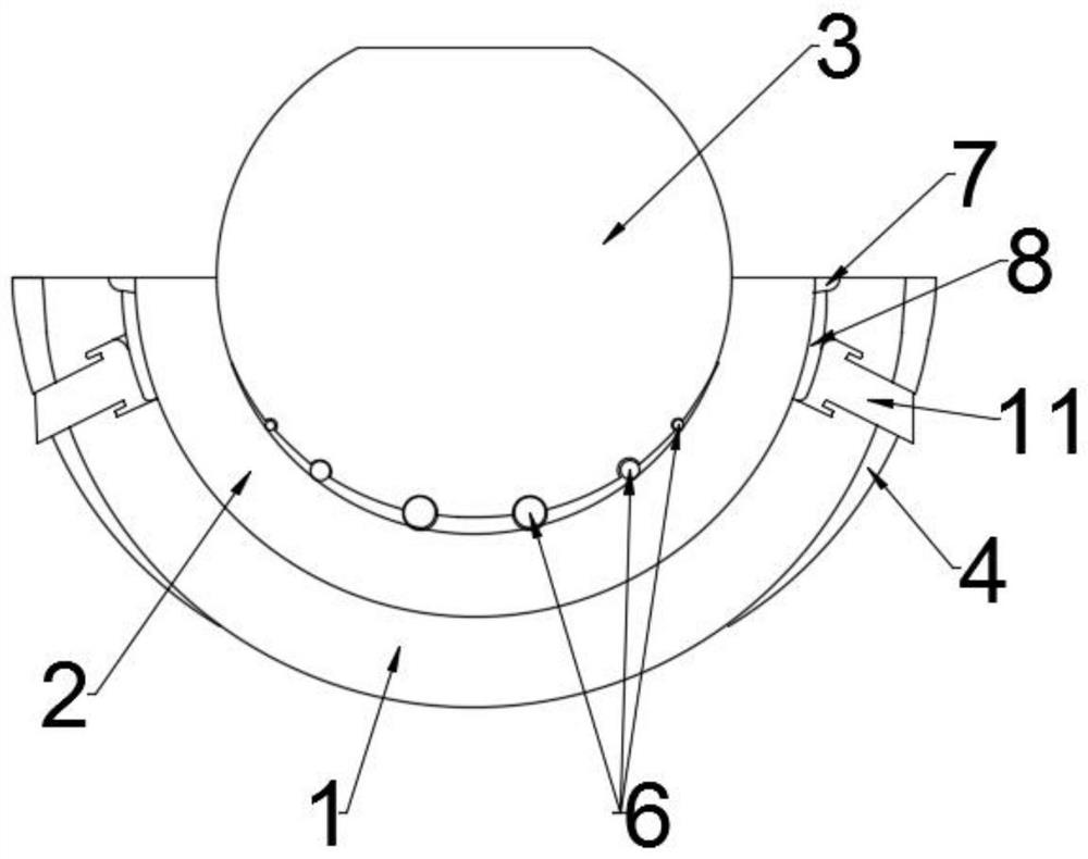 a hip prosthesis