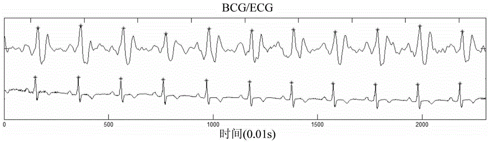 Sleep detection method and detection system based on body vibration signals