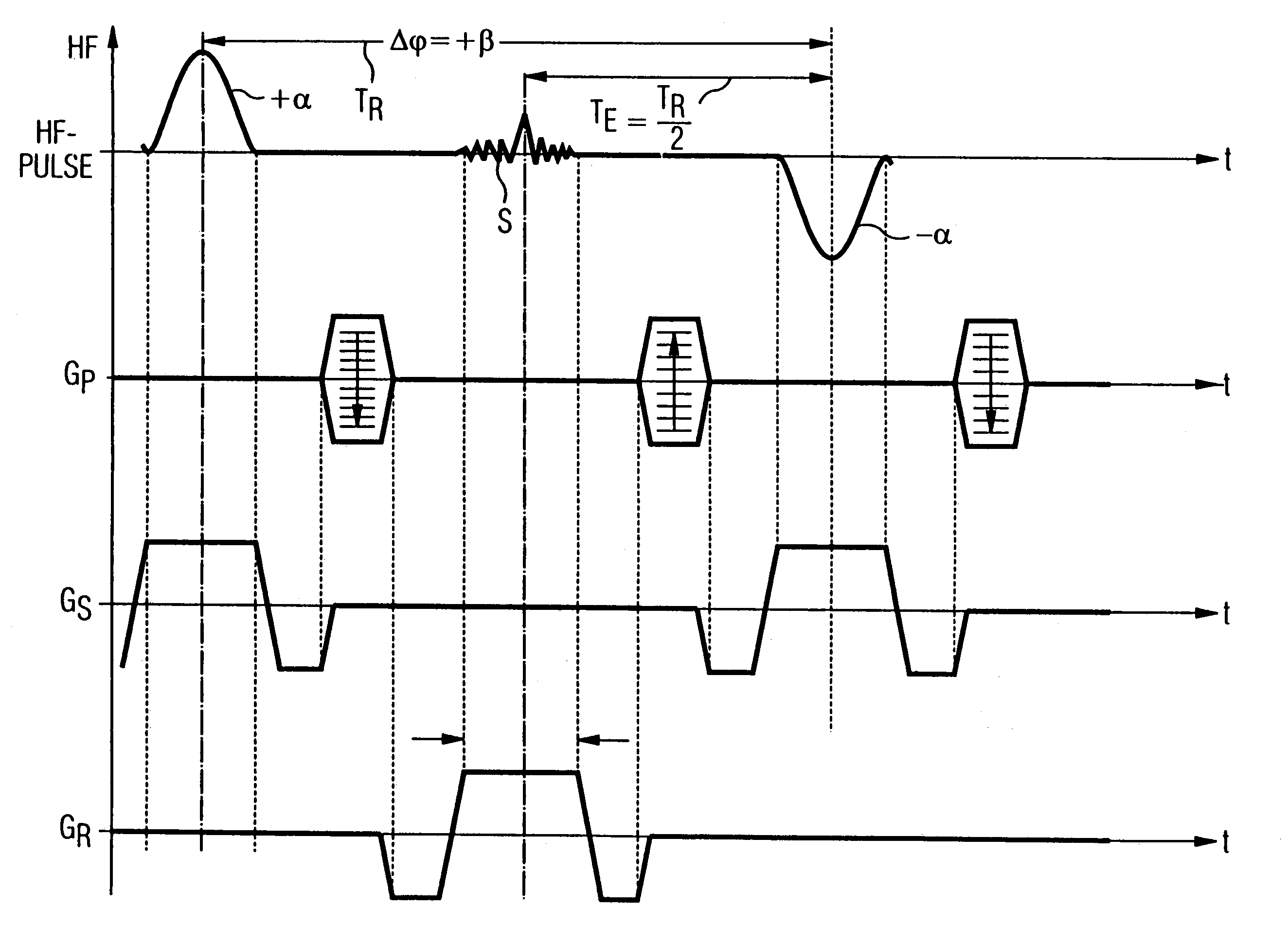 Magnetic resonance tomography apparatus and method employing a true FISP sequence with improved off-resonant behavior of two spin ensembles