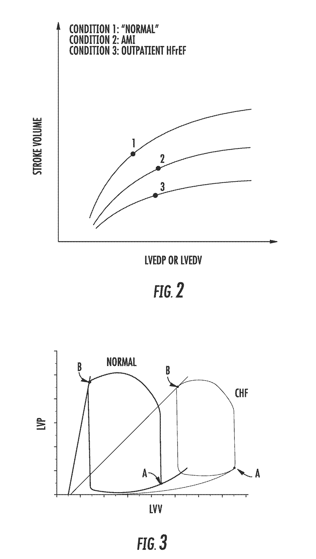 System for treating acute and chronic heart failure