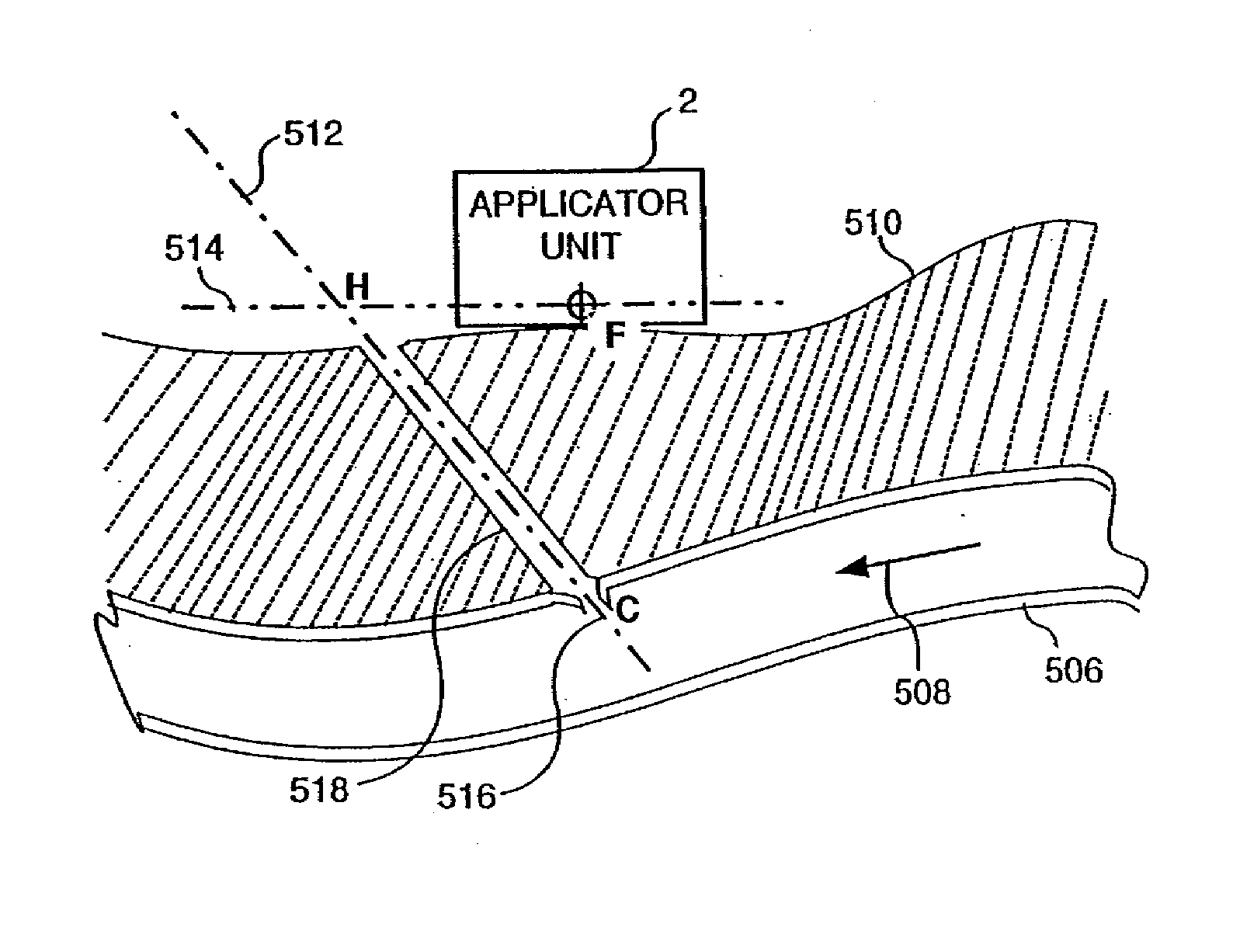 Use of focused ultrasound for vascular sealing