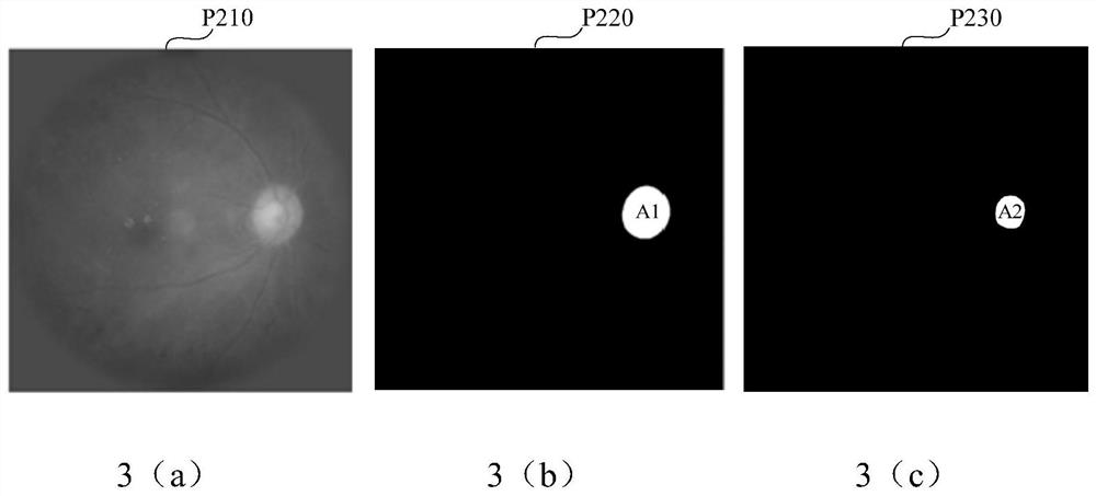 Training method, training device, recognition method and recognition system for glaucoma recognition