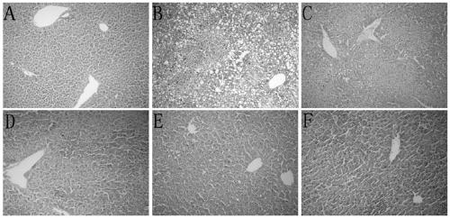 Application of crocin in preparing medicament for treating non-alcoholic steatohepatitis