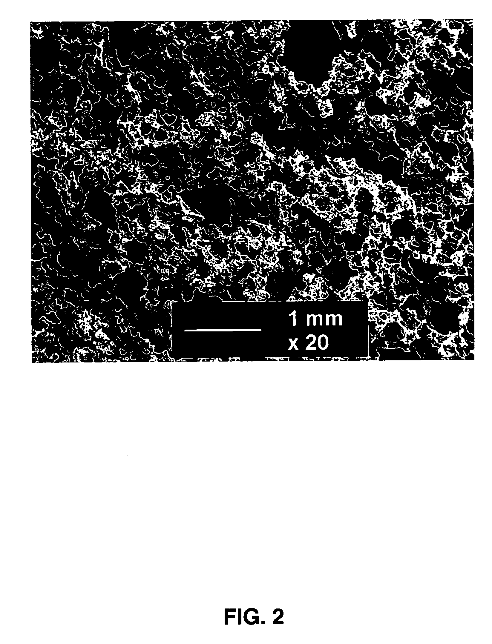 High porosity metal biporous foam