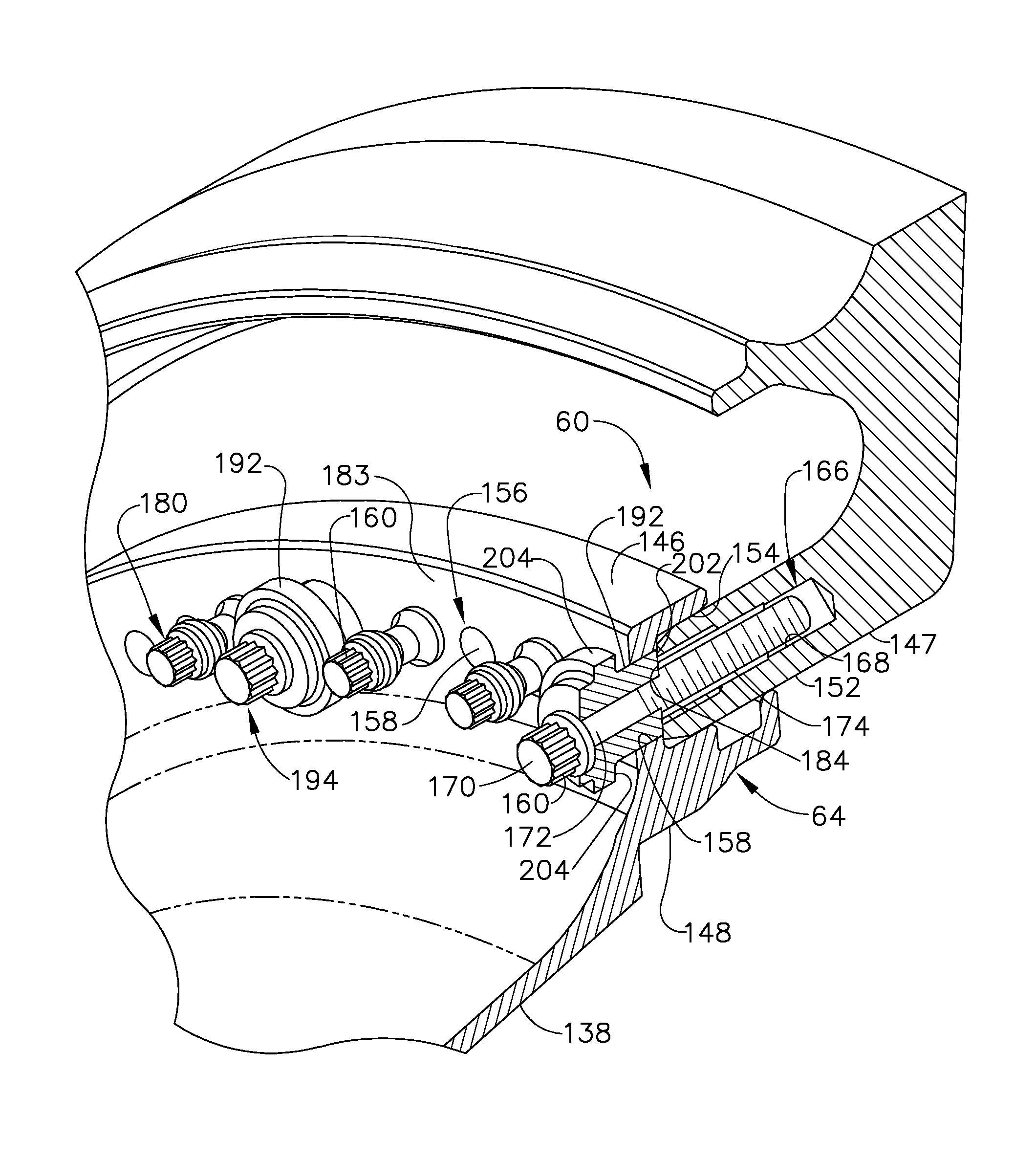 Dynamic load reduction system