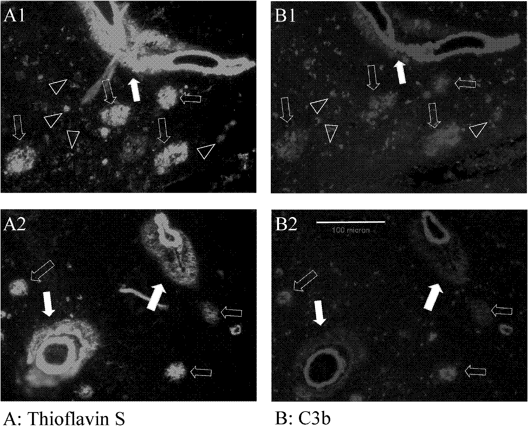 Cyclic ketone derivatives and applications thereof as developers and aggregation inhibitors of amyloid protein sediments and neurofibrillary tangles