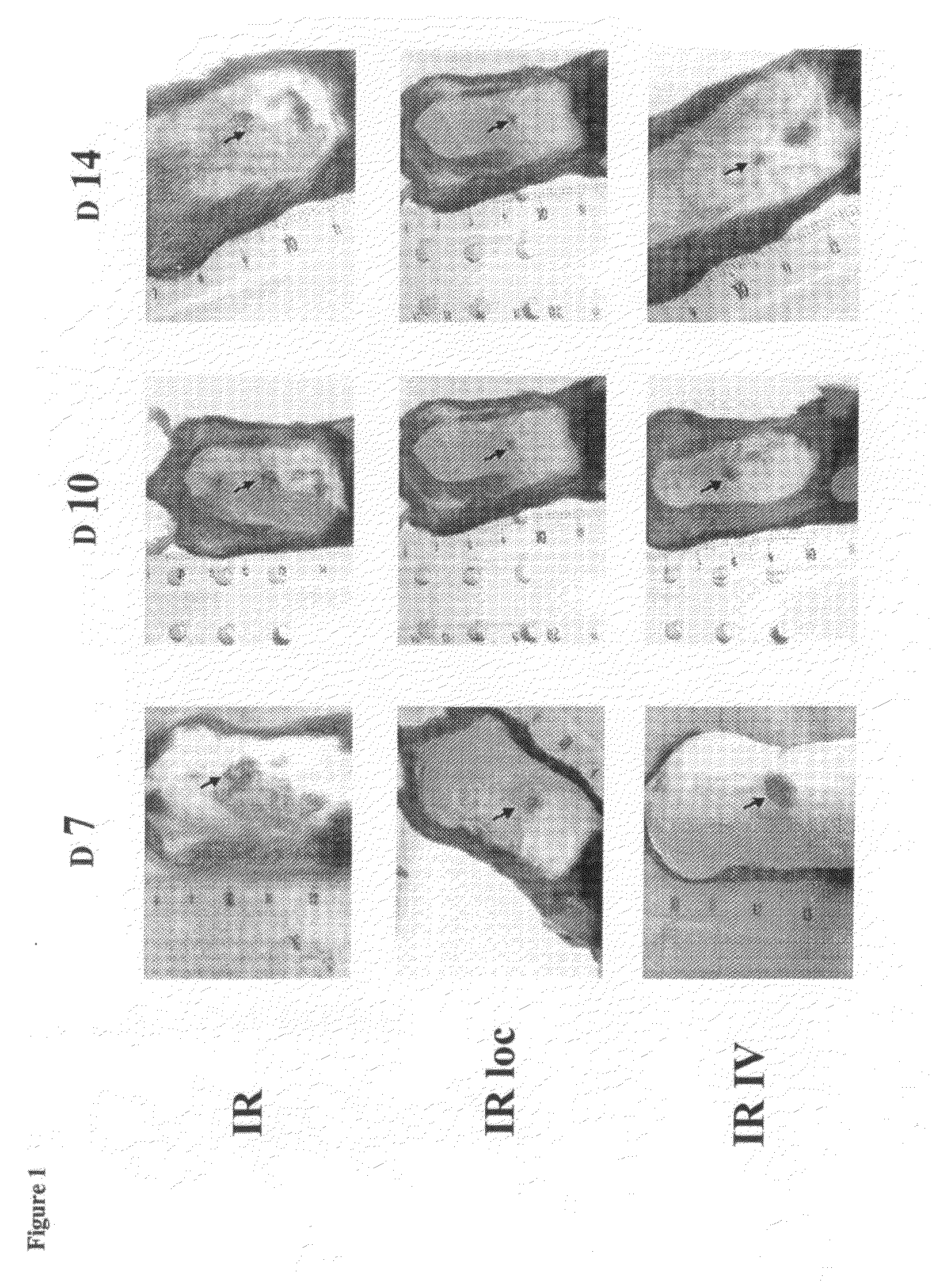 Use of Adipose-Tissue Cell Fractions for Post-Irradiation Tissue Regeneration