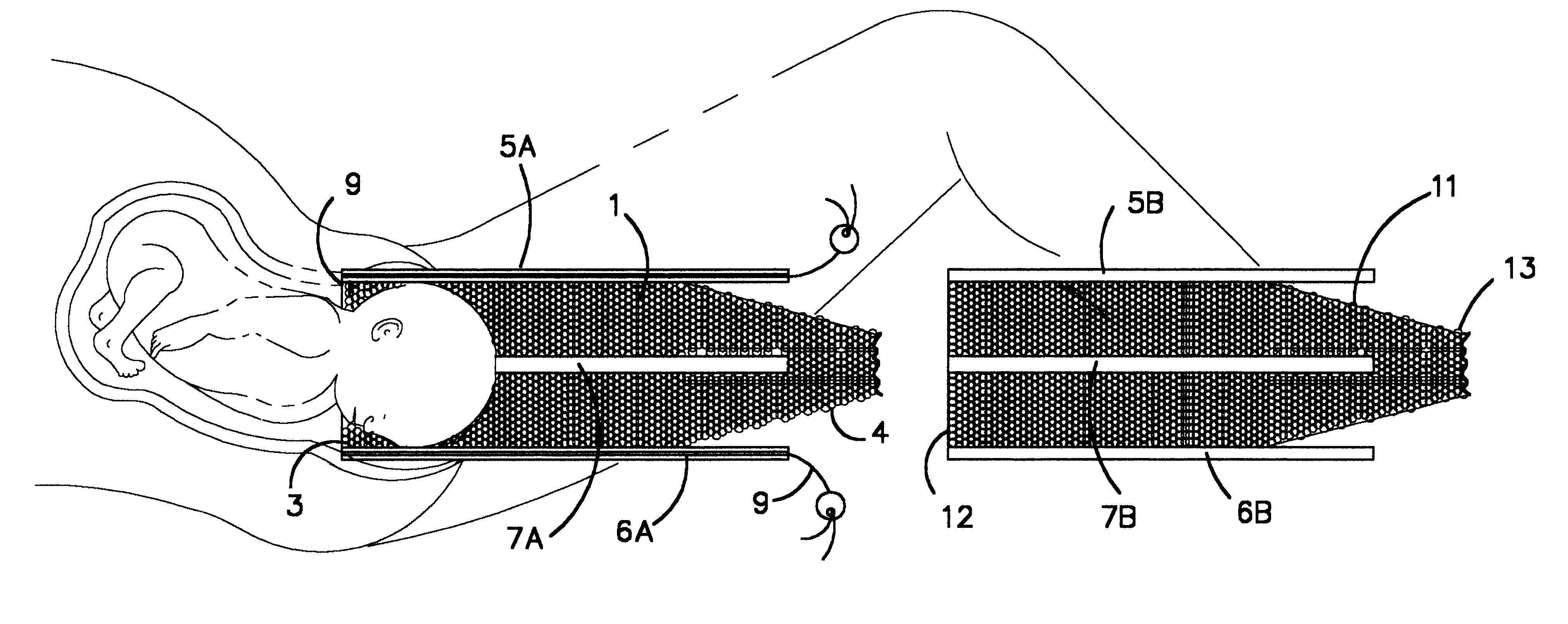 Delivery assistance device