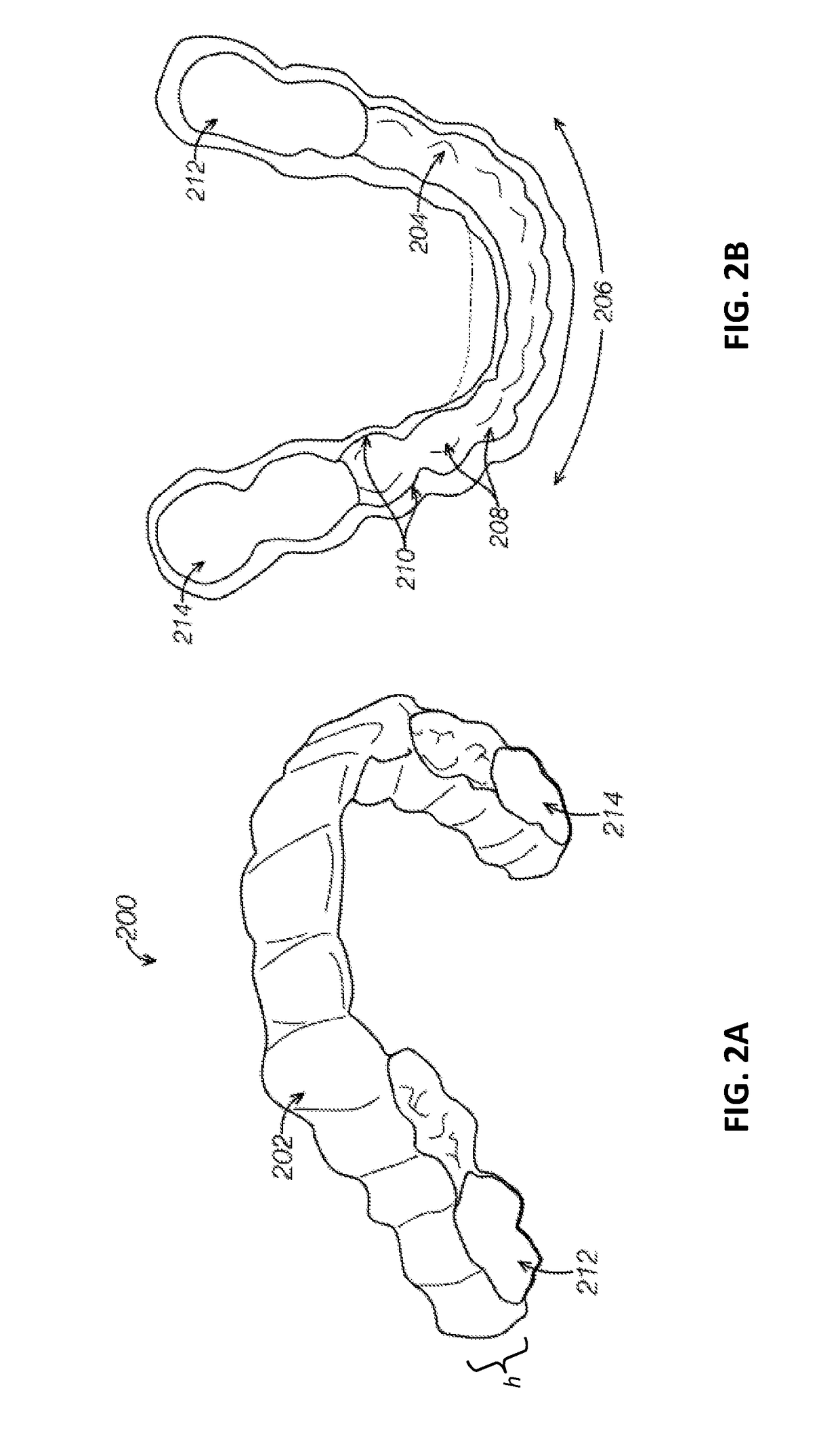 Dental appliance features for speech enhancement