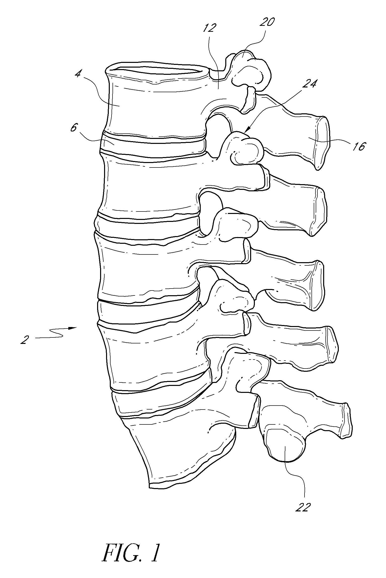 Vertebral facet joint drill and method of use