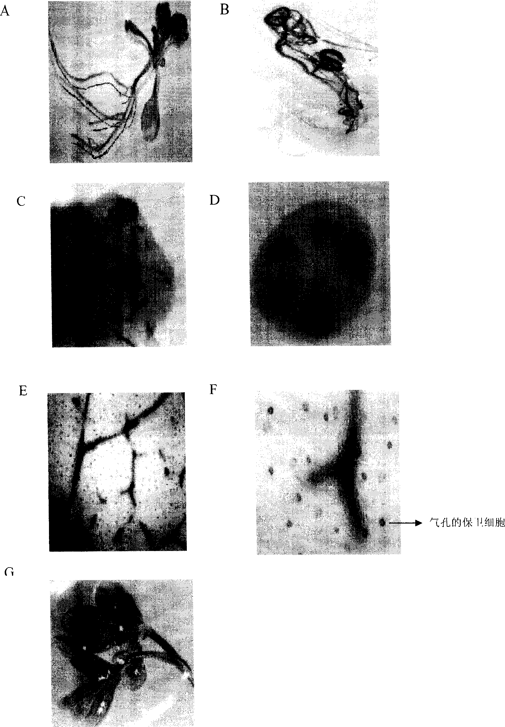 Cotton tissue specific and pathogenic bacterium inducing promoter and its use