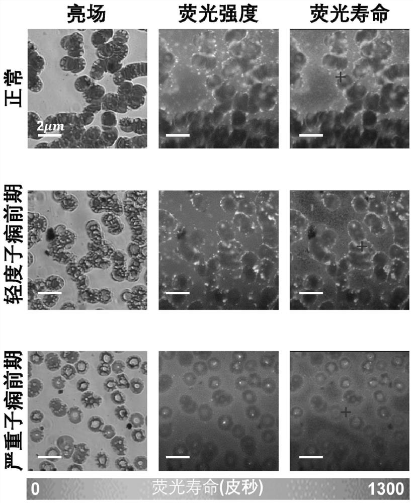 Preeclampsia diagnostic kit and application of fluorescent dye