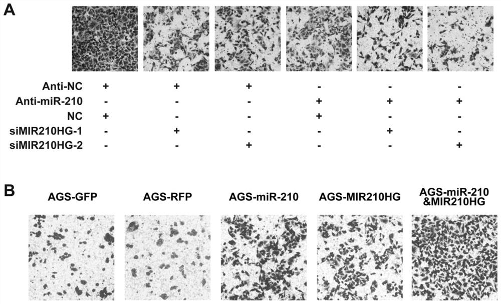 Application of micromolecule non-encoding RNA and host gene in diagnosis and treatment of gastric cancer