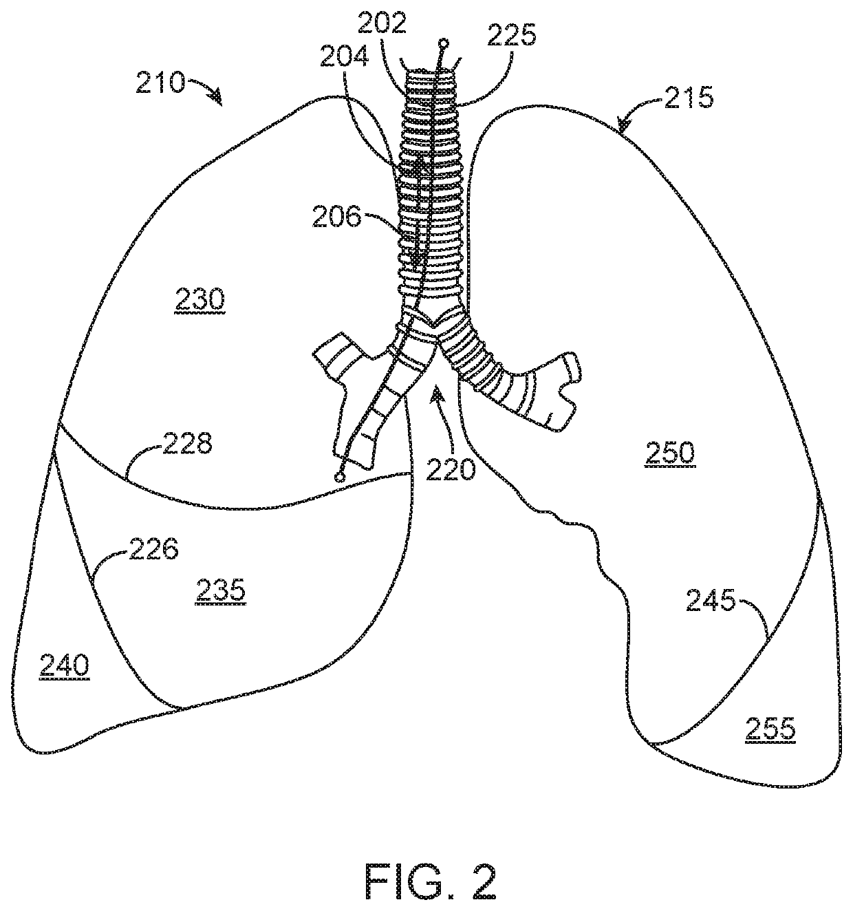 High resistance implanted bronchial isolation devices and methods