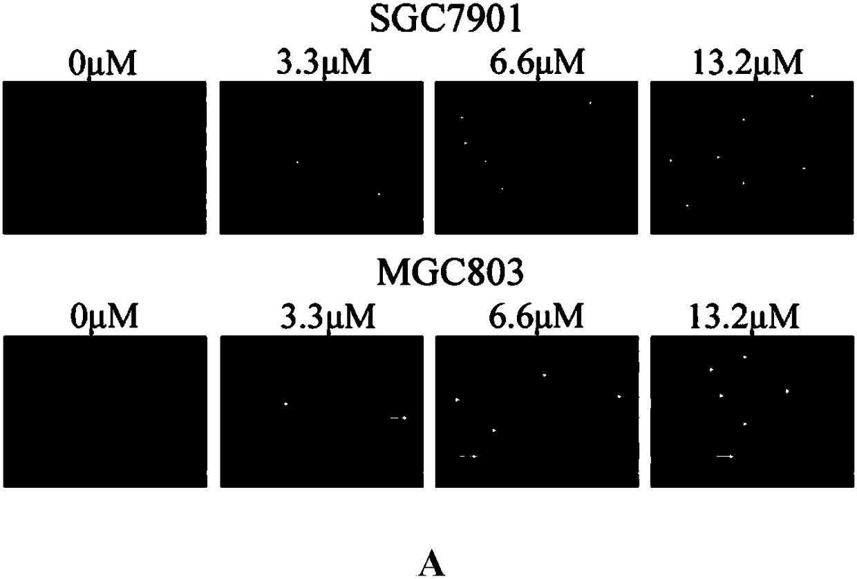 Zeylenone inhibiting gastric carcinoma cell proliferation, invasion, migration and apoptosis induction