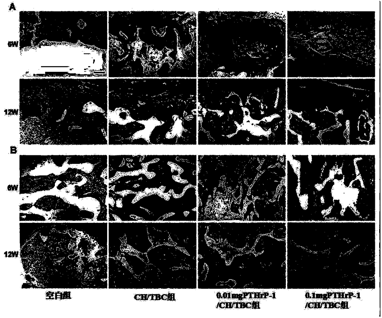 Active polypeptide capable of promoting osteogenesis and inhibiting osteoclast and application of active polypeptide