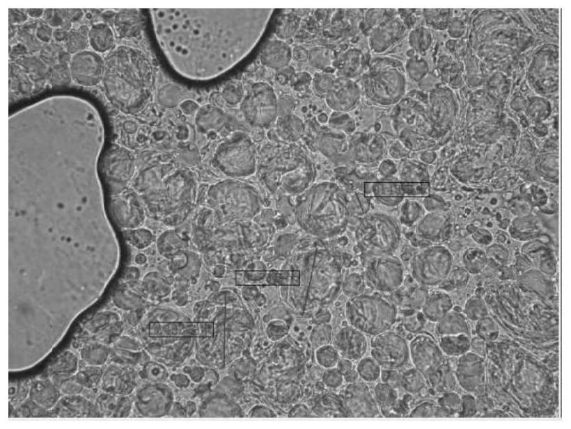 Itching-relieving emulsifiable paste for treating anal itching and preparation method of itching-relieving emulsifiable paste