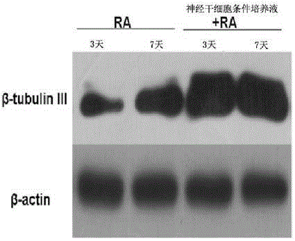 Method for inducing neuroblastoma cells to be differentiated to nerve cells