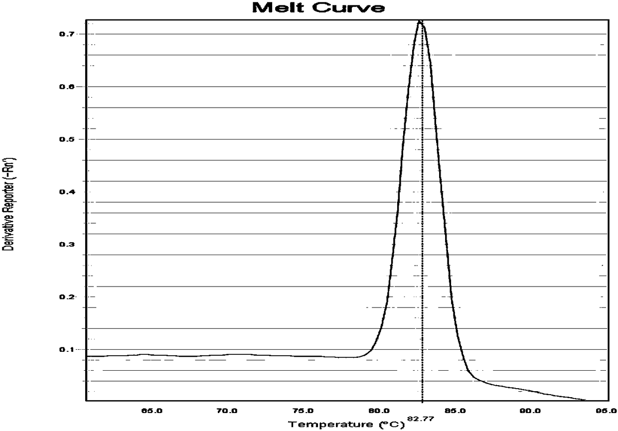 Theileria annulata SYBR Green I real-time fluorescence PCR (Polymerase Chain Reaction) specific primer as well as detection kit and detecting method