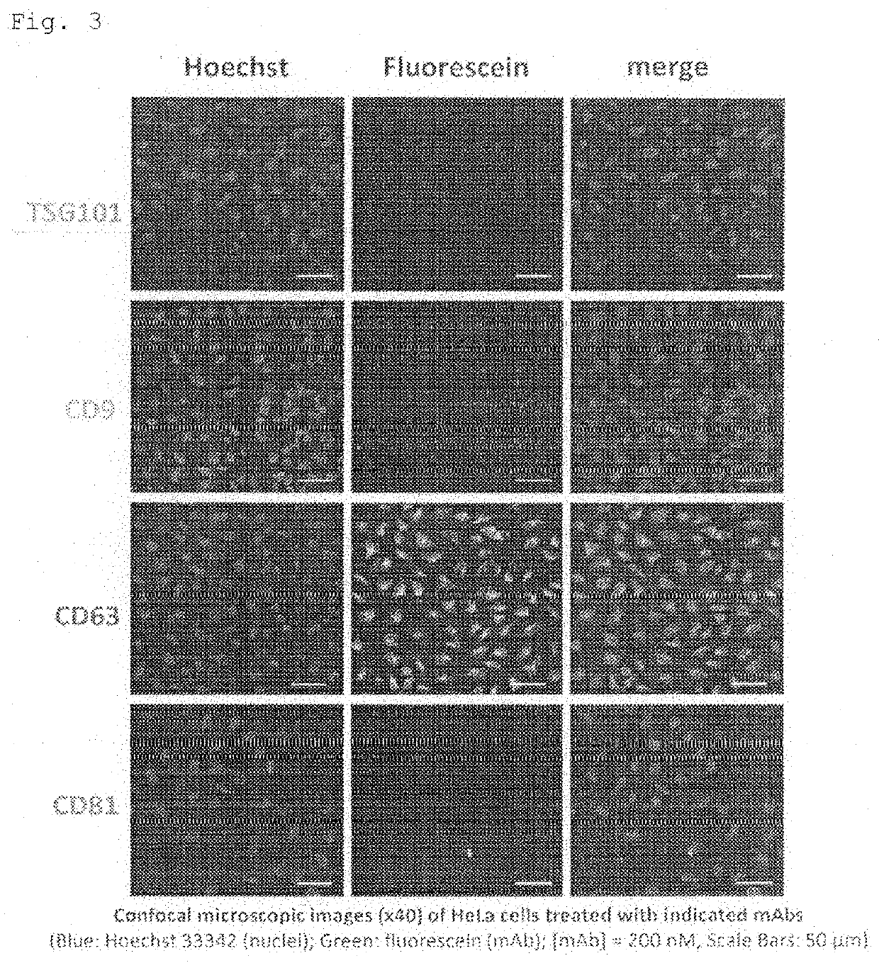 Complex capable of inhibiting genetic function in exosome, and cancer  proliferation and/or metastasis suppressor