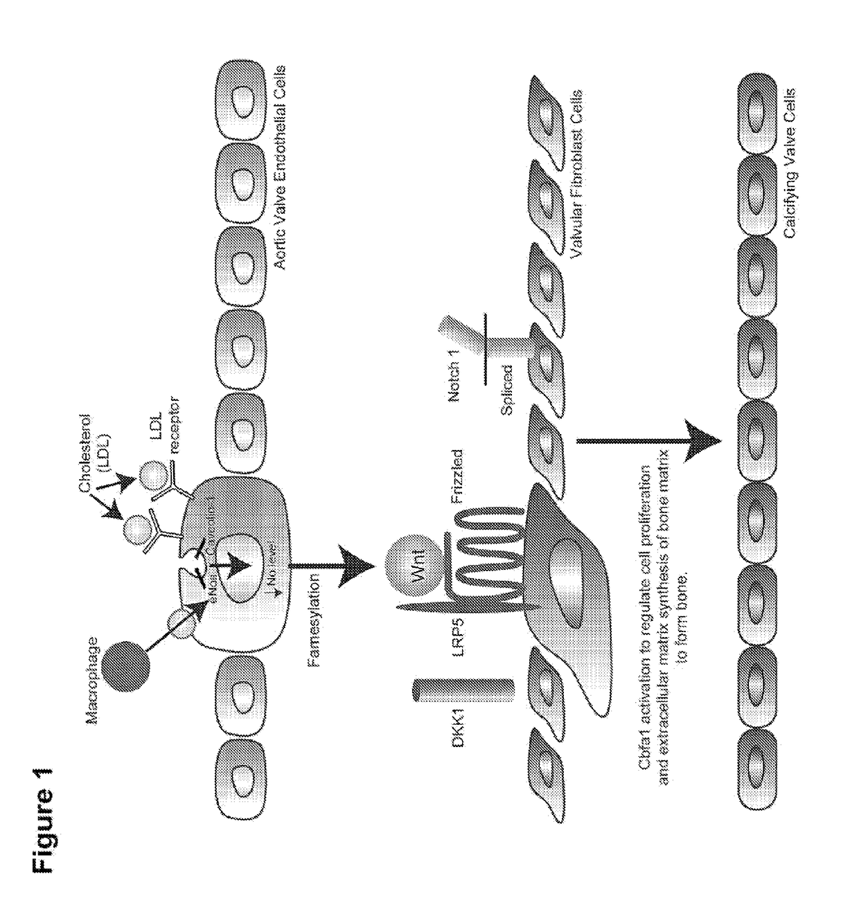 Devices and methods for inhibiting stenosis, obstruction, or calcification of a native heart valve, stented heart valve or bioprosthesis