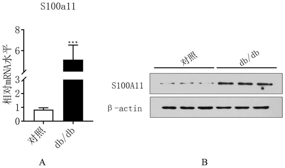 Application of s100a11 protein as a diabetes biomarker and therapeutic target