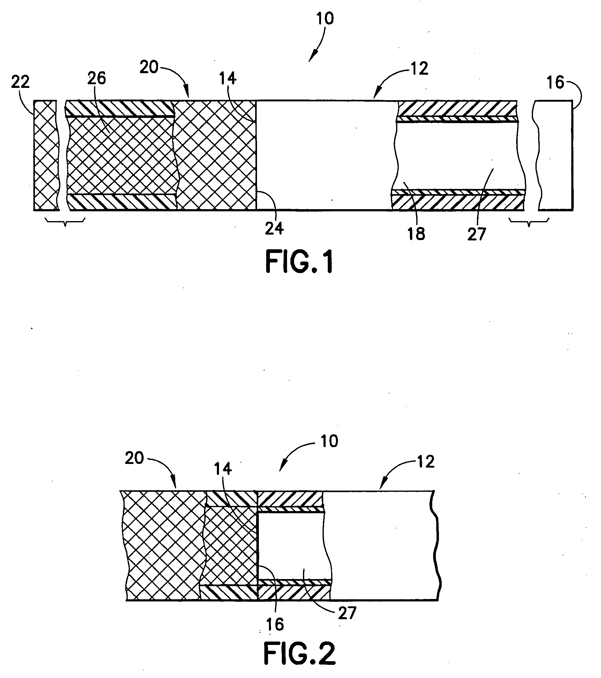 Stent/graft assembly