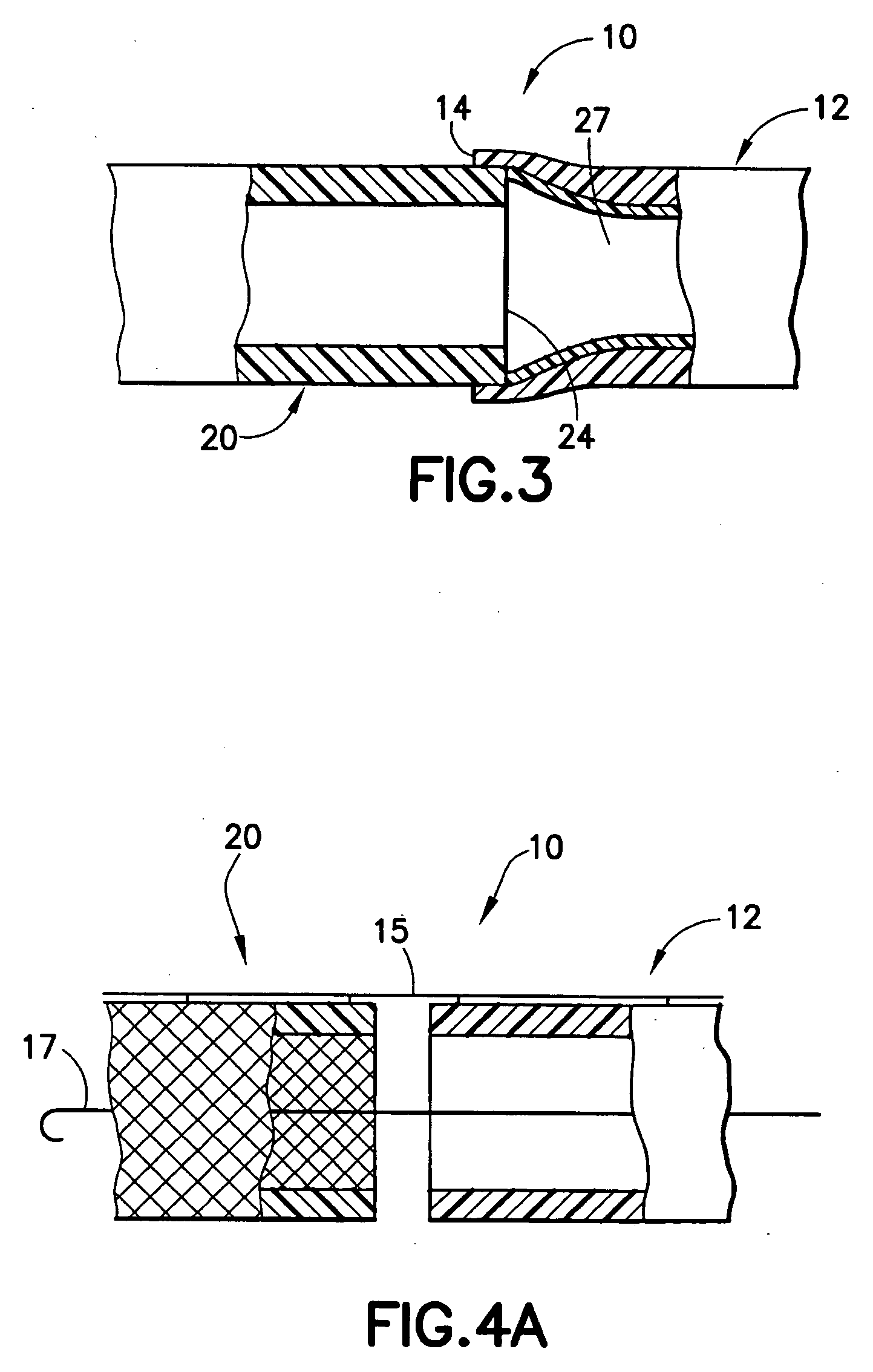 Stent/graft assembly