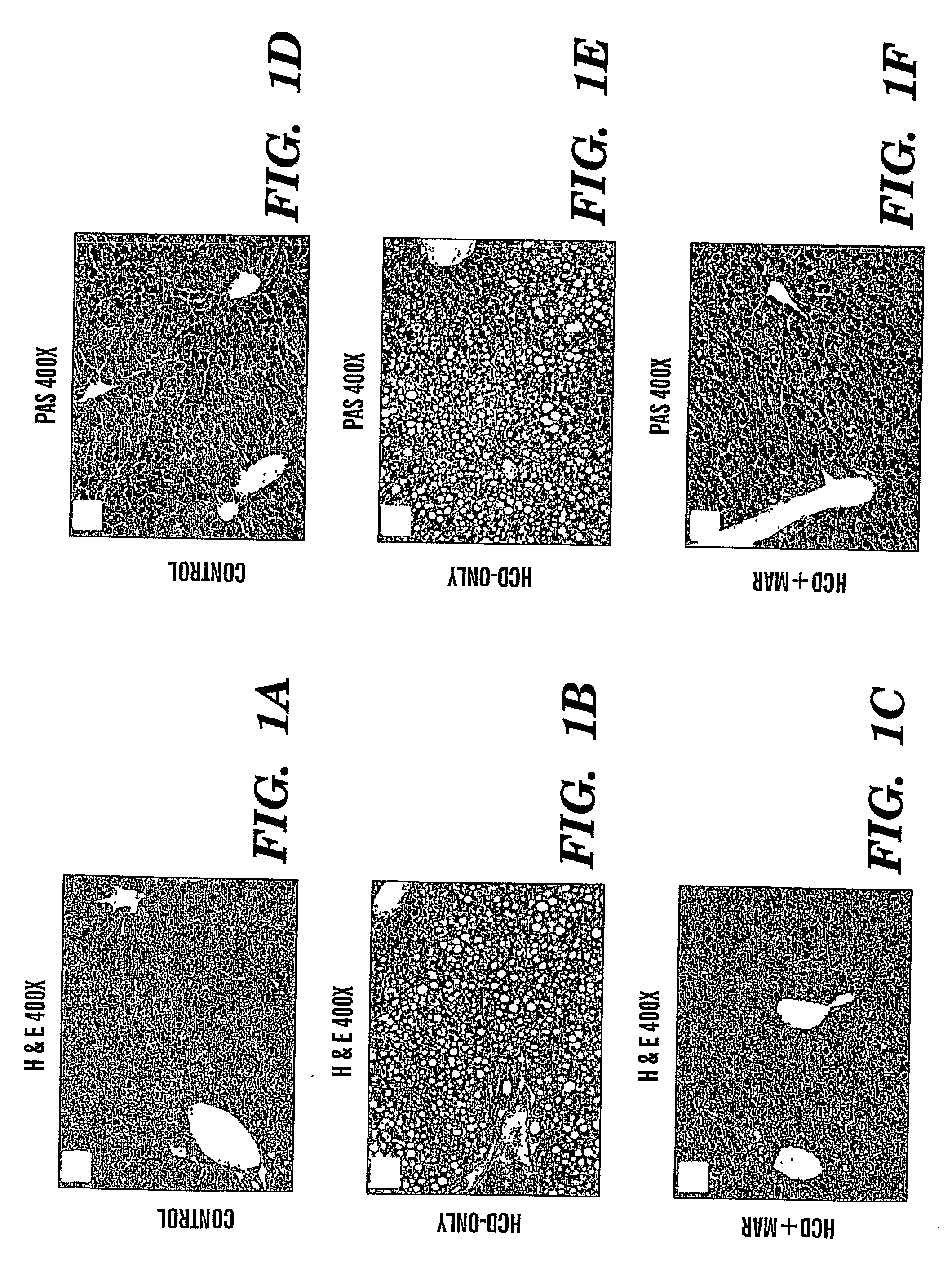 Method of treating fatty liver disease