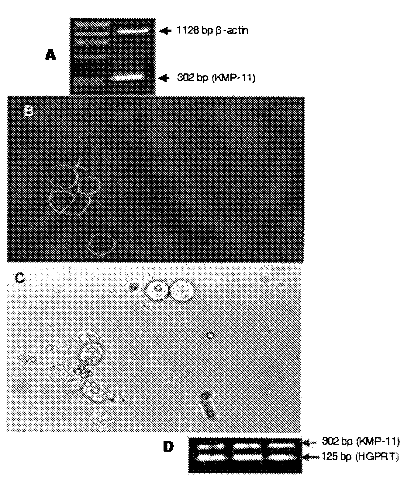 DNA vaccine as immunoprophylaxis against kala-azar