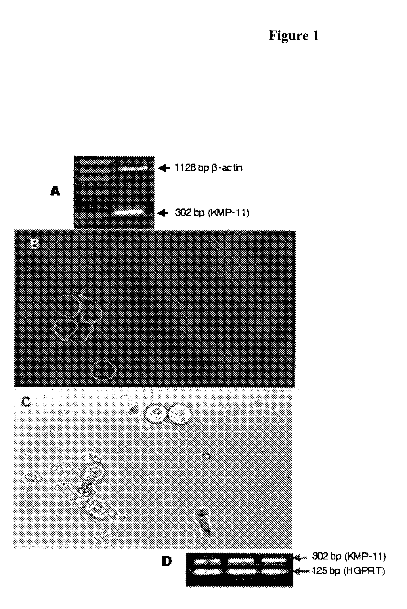 DNA vaccine as immunoprophylaxis against kala-azar