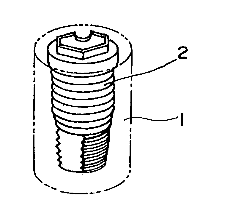 Method for fixing an implant, fixing member for the implant and implant composite