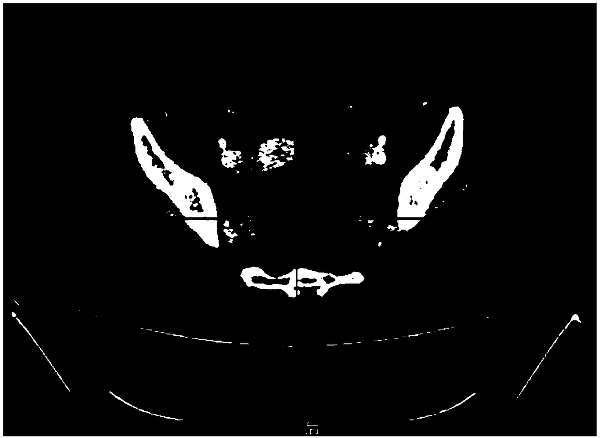 Multi-directional-contour-based medical image segmentation method