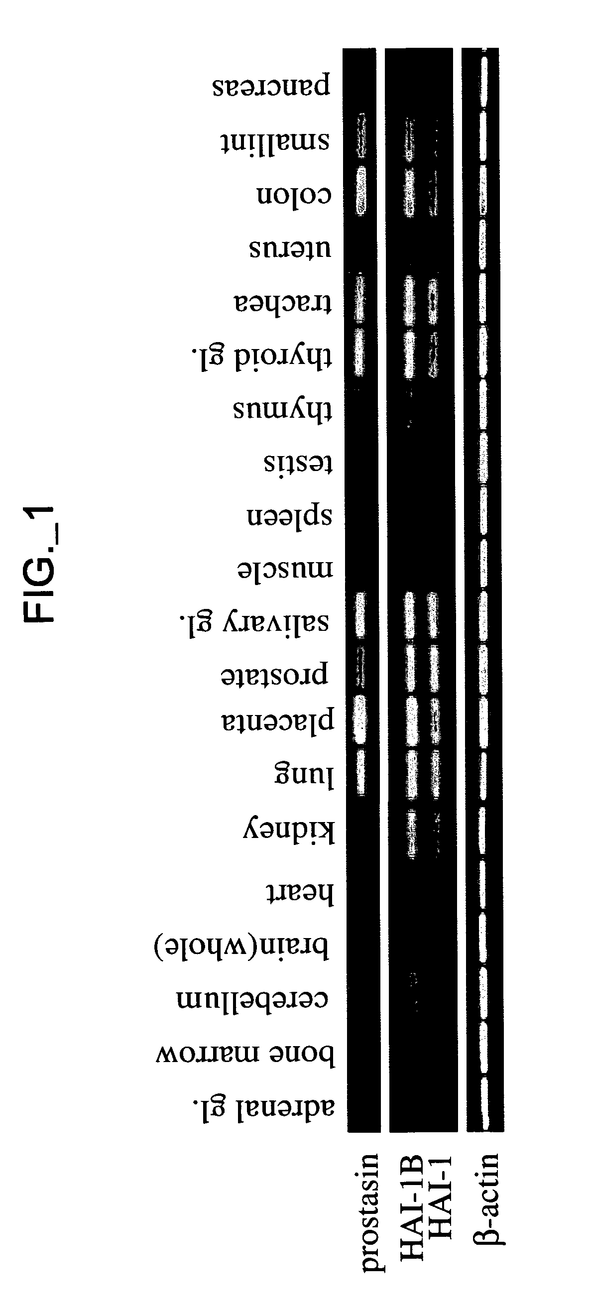 Methods and compositions for modulating prostasin