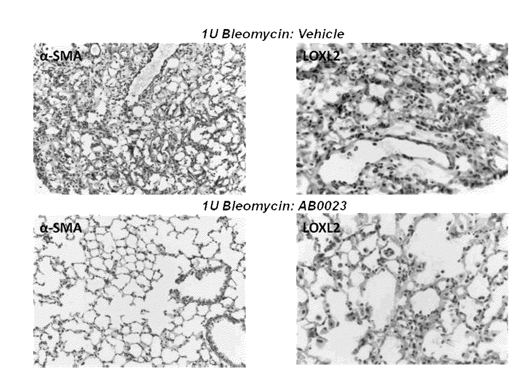 Methods and compositions for treatment of pulmonary fibrotic disorders