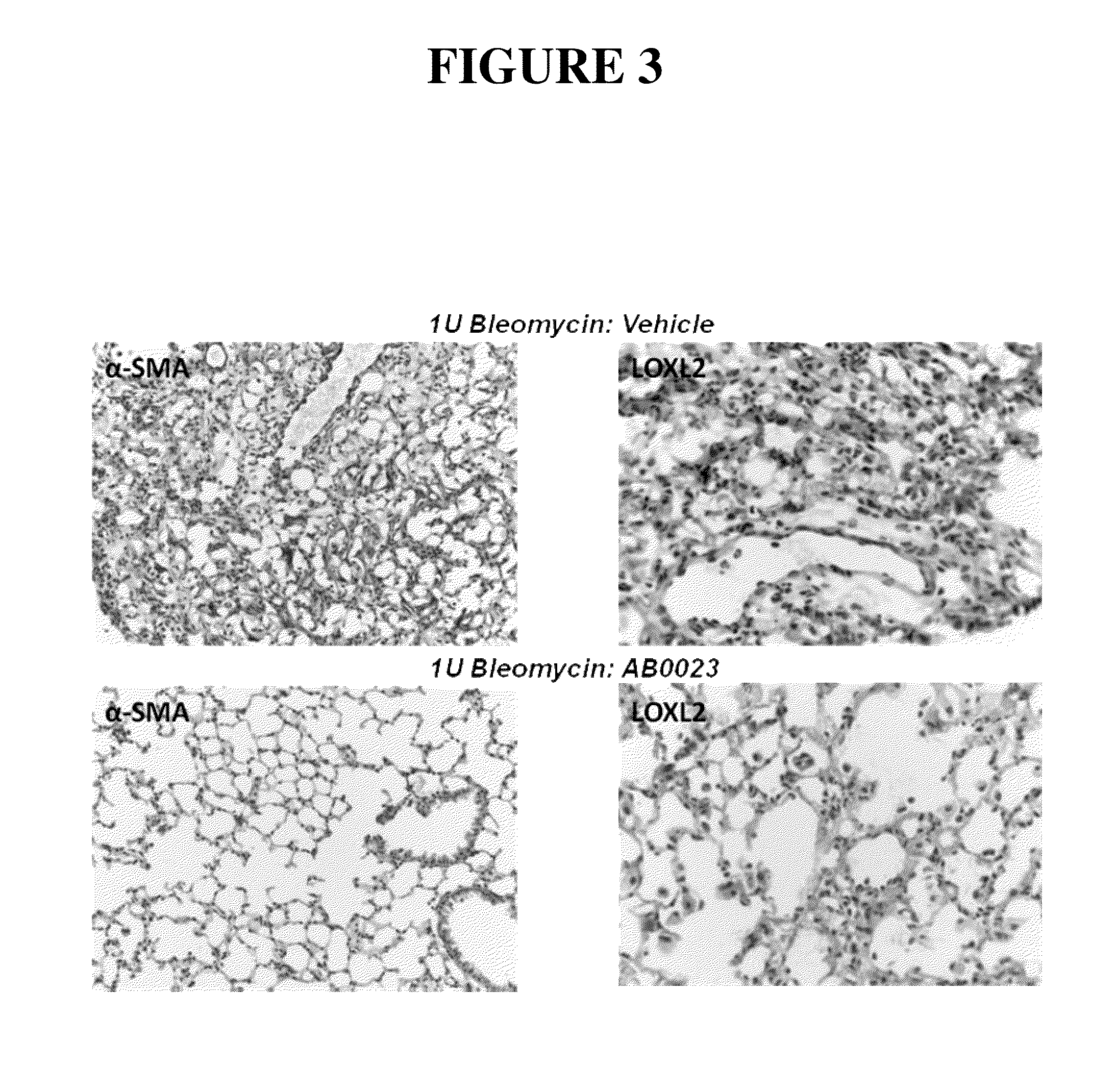 Methods and compositions for treatment of pulmonary fibrotic disorders