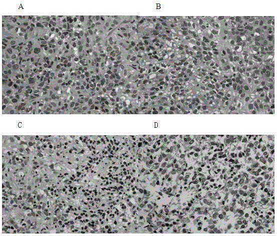 Ovarian cancer tissue 3D cultivation method and application of 3D cultivated cancer tissue to efficacy evaluation