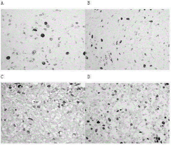 Ovarian cancer tissue 3D cultivation method and application of 3D cultivated cancer tissue to efficacy evaluation