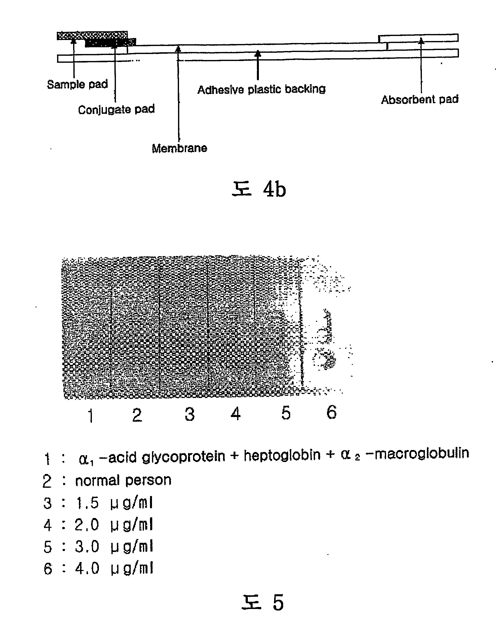 Monoclonal antibody against asialo alpha 1-acid glycoprotein, immunochromatographic strip comprising the monoclonal antibody, and method for diagnosing liver diseases using the immunochromatographic strip