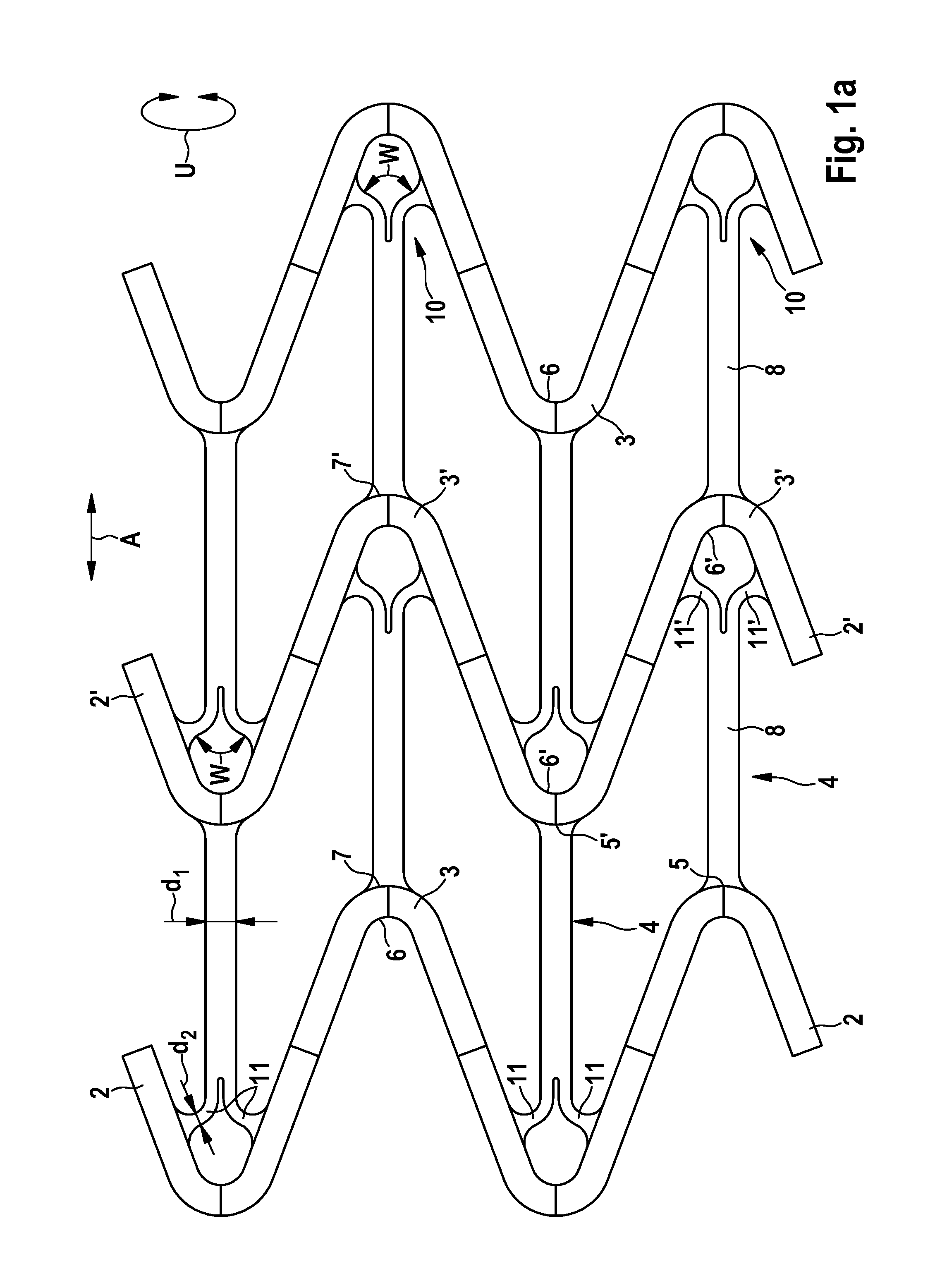 Stent having improved stent design